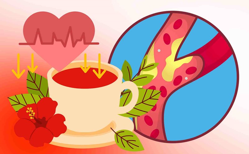 Drinks that help lower blood pressure and reduce the risk of atherosclerosis