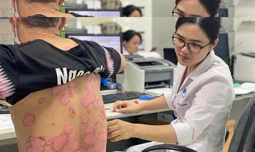 Triển khai khám miễn phí cho người bệnh vảy nến tại Bệnh viện Da liễu Trung ương. Ảnh: BVCC