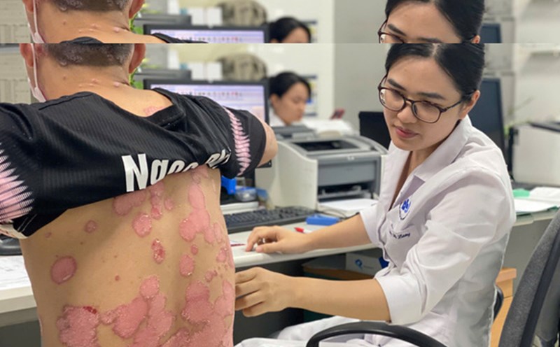 Deploying free examination for psoriatic patients at the Central Dermatology Hospital. Photo: BVCC