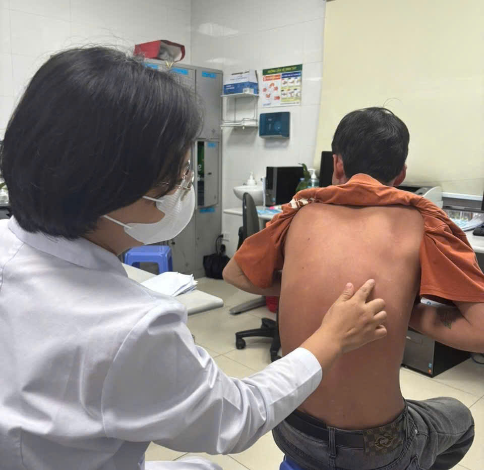 Benh vien Da lieu Trung uong se trien khai kham mien phi cho nguoi benh vay nen. Anh: BVCC