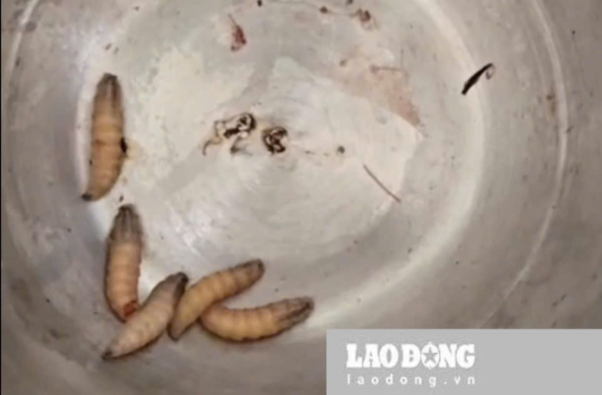 The hoes were removed from the patient's ears by doctors at Khanh Hoa General Hospital. Photo: Phuong Linh