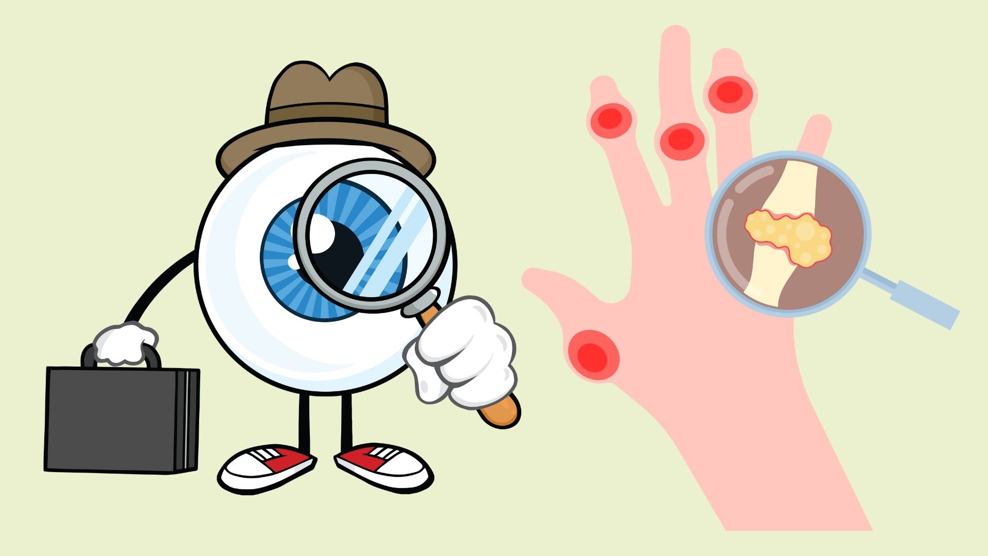 Looking at the eyes predicts high uric acid. Graphics: Linh Dan