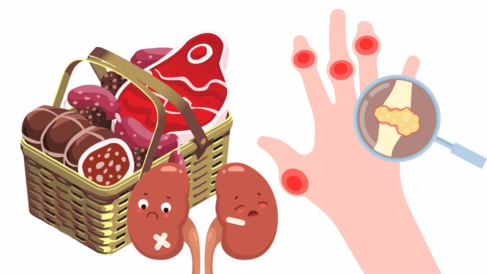 Red meat can increase uric acid and kidney failure. Graphics: Ha May