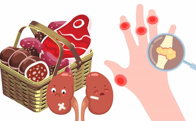Red meat can increase uric acid and kidney failure. Graphics: Ha May