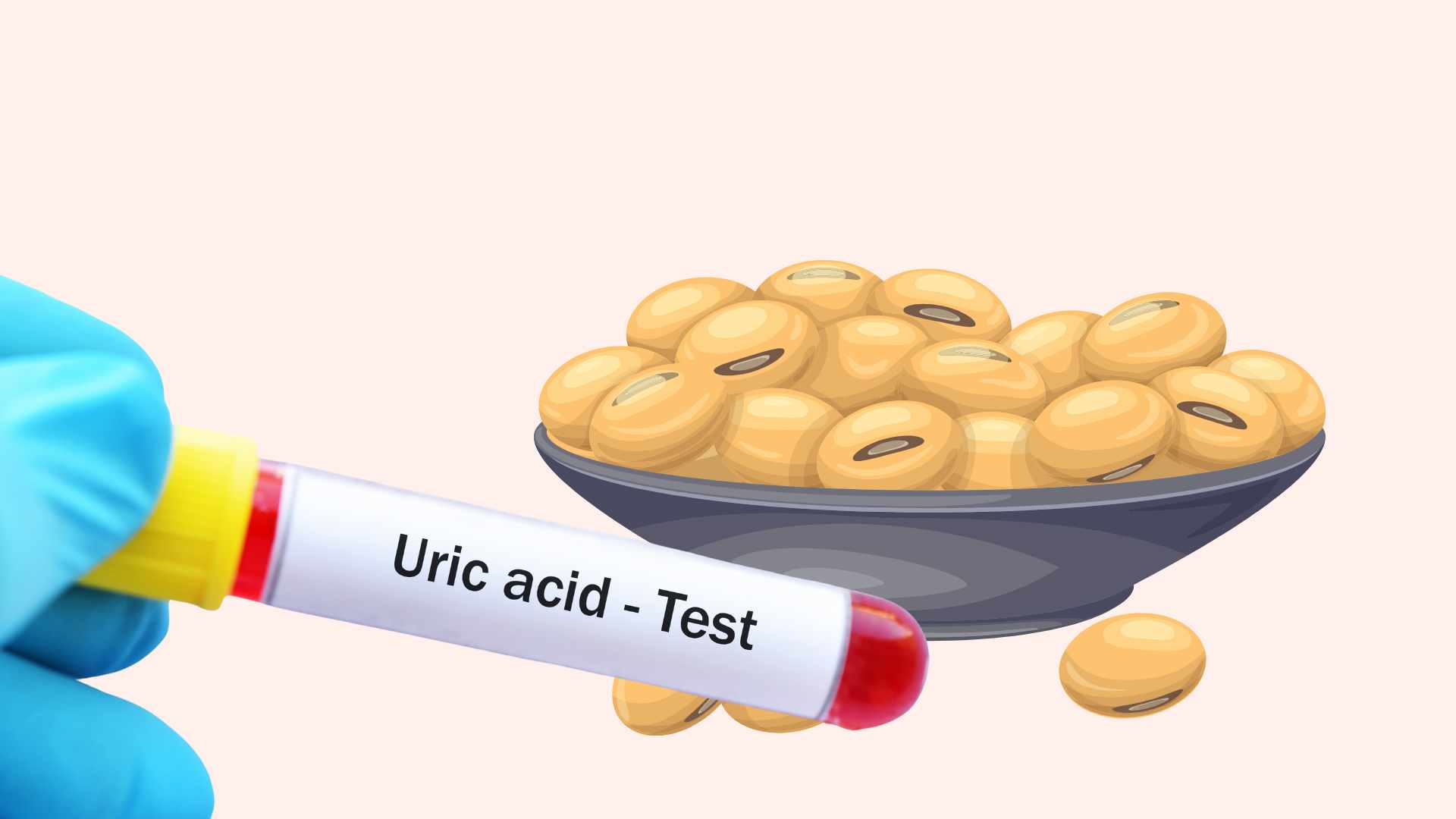 How to eat soybeans to reduce uric acid. Graphic photo: Hoang Loc