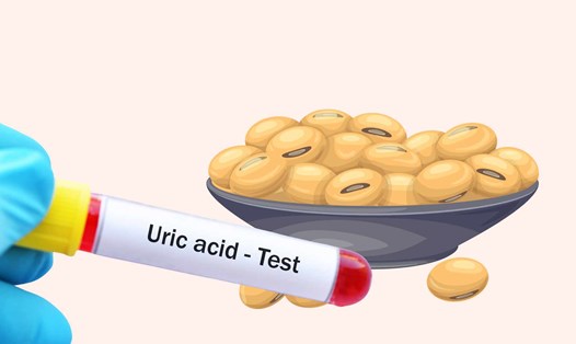 Cách ăn đậu nành giúp giảm axit uric. Ảnh đồ họa: Hoàng Lộc