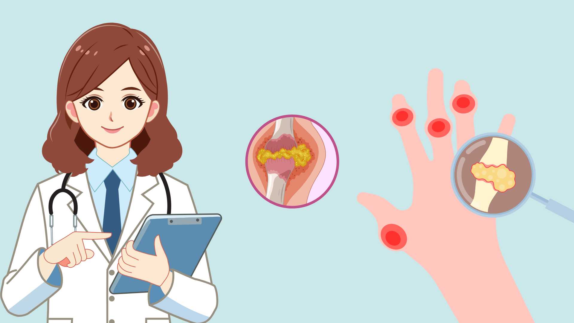 Celery seeds contain many biological compounds that can inhibit the enzyme that produces uric acid. Graphic photo: Huong Son