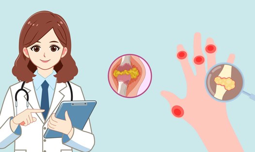 Hạt cần tây chứa nhiều hợp chất sinh học có khả năng ức chế enzyme sản xuất axit uric. Ảnh đồ hoạ: Hương Sơn