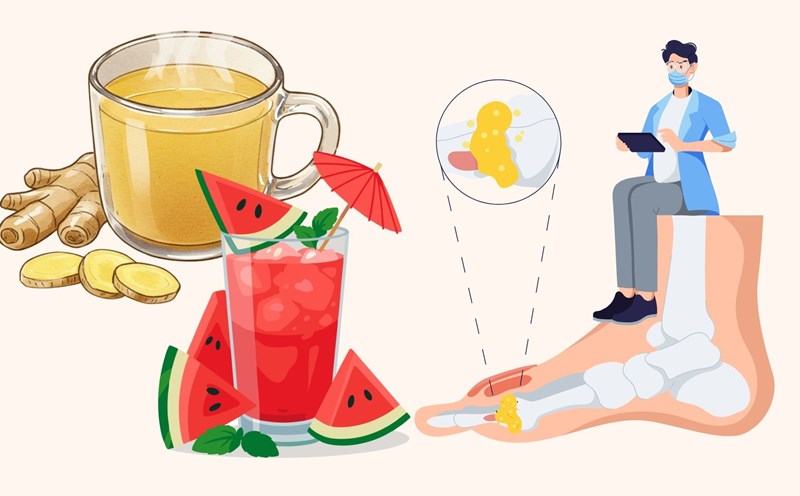 This easy-to-find drink helps eliminate uric acid effectively. Graphics: Linh Dan