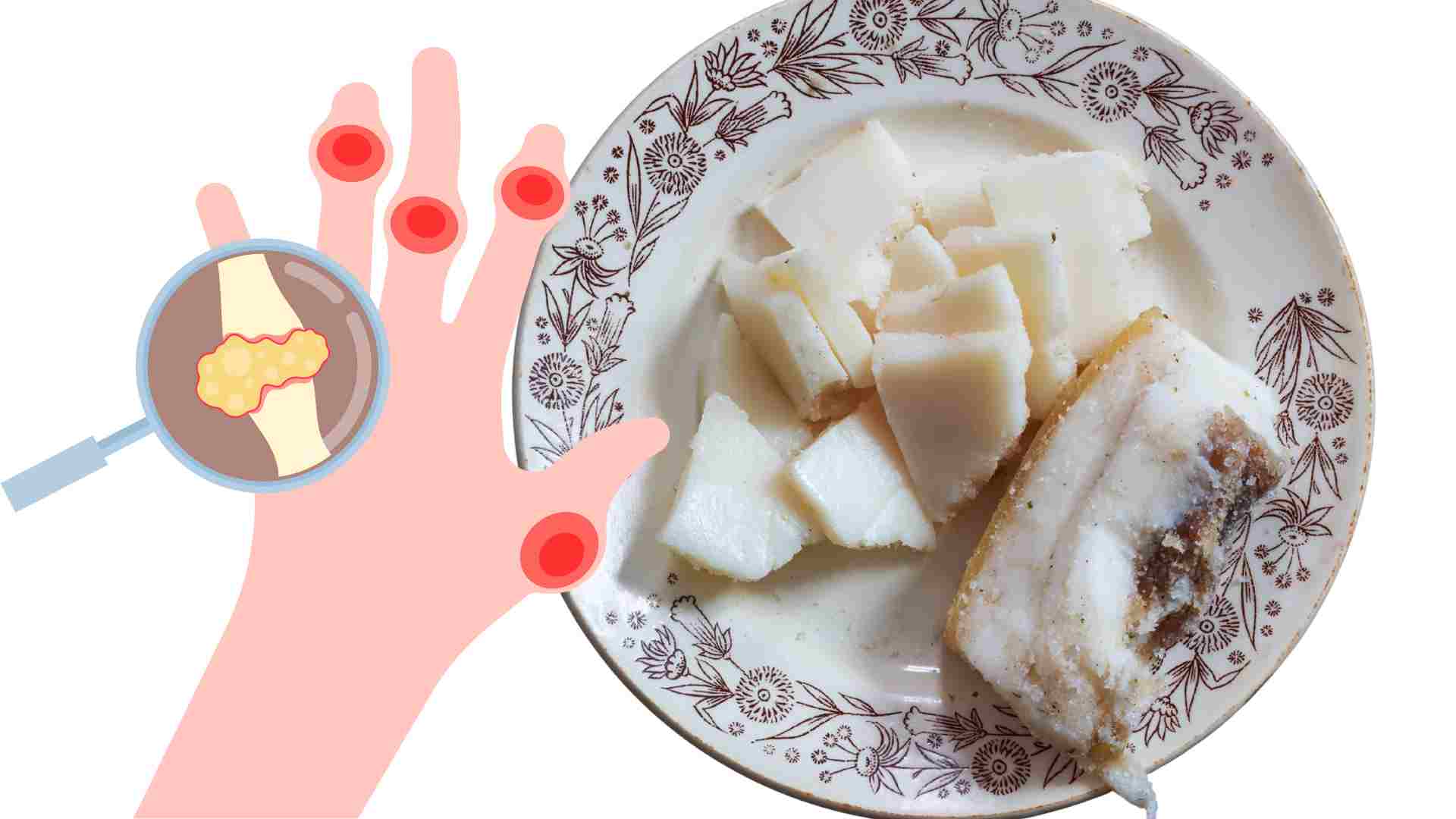 Eating too much fatty meat and walnuts will affect uric acid. Graphics: Ha May