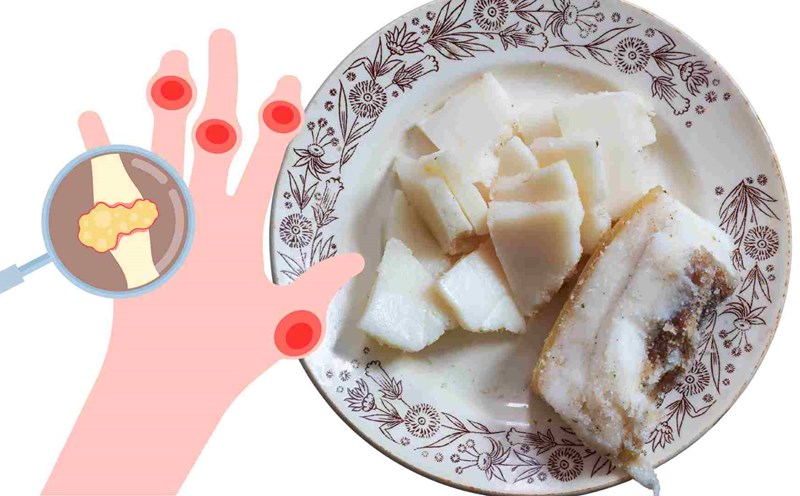 Eating too much fatty meat and walnuts will affect uric acid. Graphics: Ha May