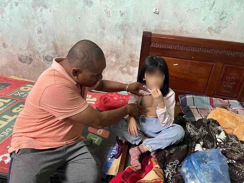 Chau thu hai trong gia dinh bi benh tim bam sinh. Anh: Mai Huong