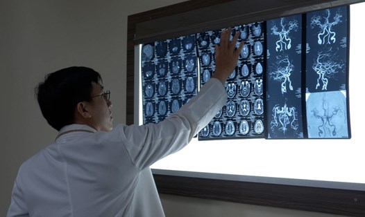 Phòng tránh nguy cơ đột quỵ khi chơi thể thao