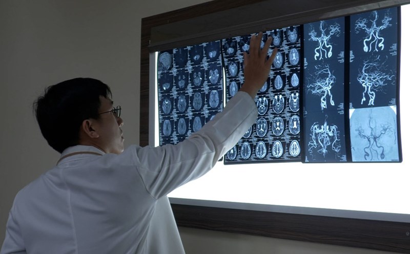 Preventing the risk of stroke while playing sports