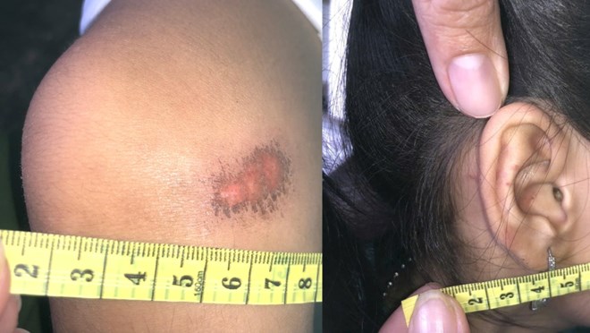 Công an vào cuộc xác minh vụ người phụ nữ bị tố bạo hành bé gái 6 tuổi ở An Giang