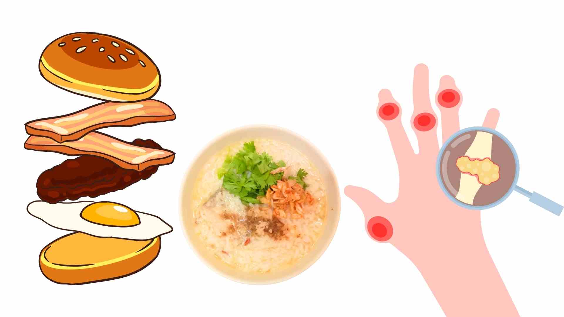 Some breakfast dishes can increase uric acid. Graphics: Ha May