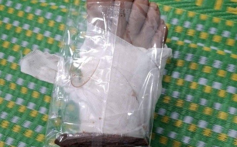 Lieutenant Colonel Dinh Quang Tien - Head of Son Tay Commune Police, Quang Ngai Province, while on duty to help people, was stabbed in the foot by a wooden tree. Photo: Quang Ngai Provincial Police