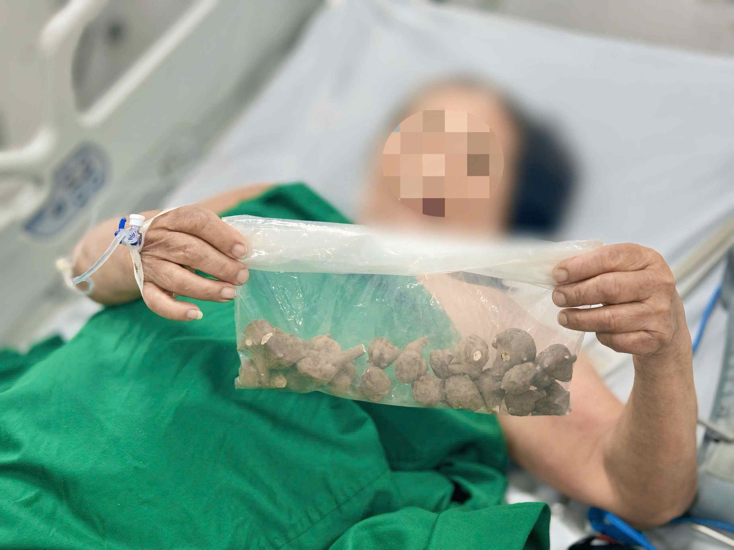 가공되지 않은 아우떠우 뿌리를 마신 후 위독합니다. 사진: Thanh Dang