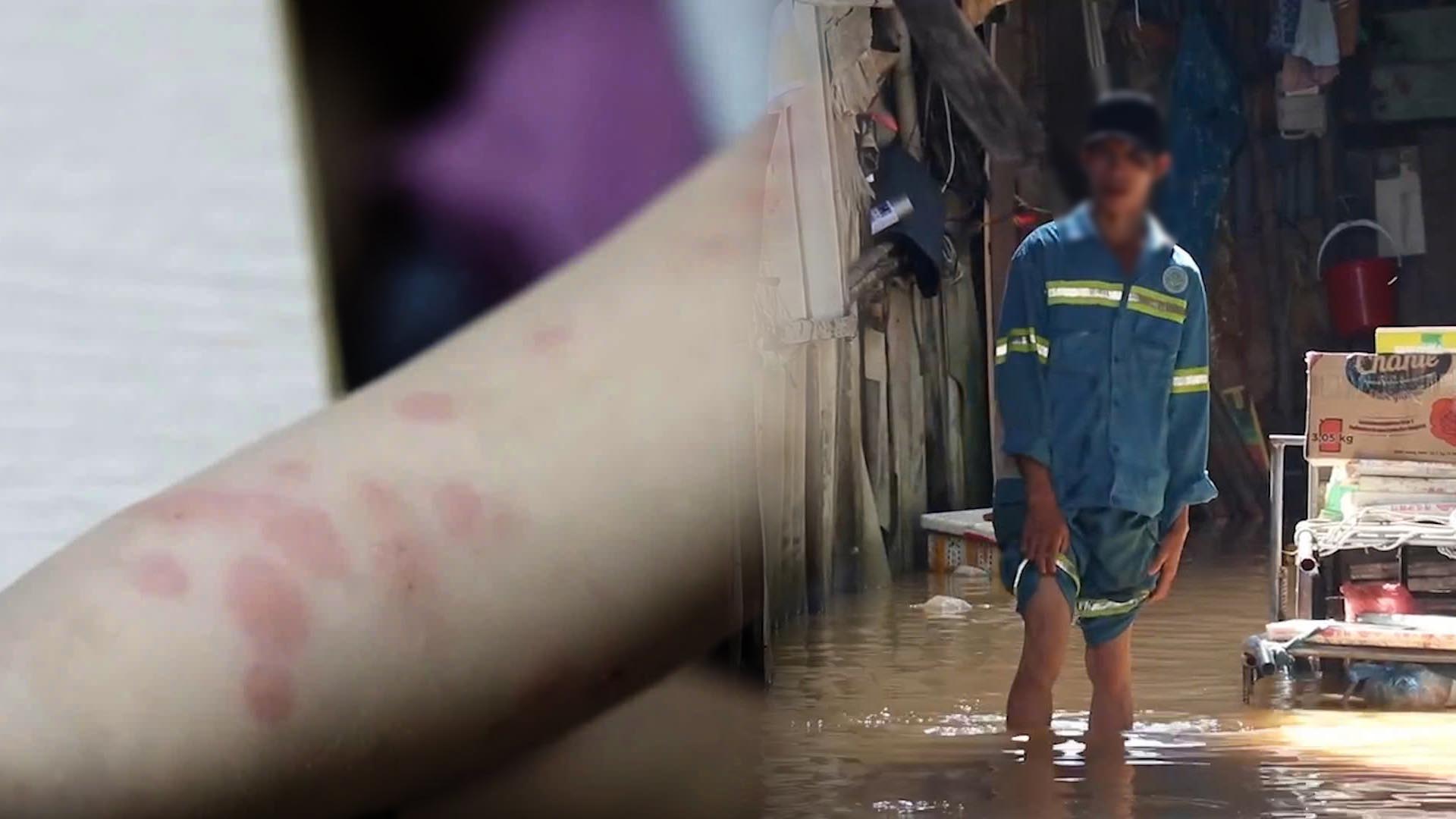 Flooding after heavy rain, warning of skin diseases and things people need to pay attention to