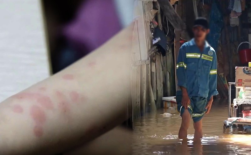 Flooding after heavy rain, warning of skin diseases and things people need to pay attention to