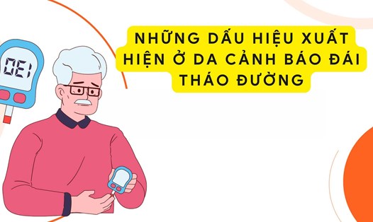Khi bệnh đái tháo đường ảnh hưởng lên da, đây thường là dấu hiệu của tình trạng đường huyết khá cao. Ảnh đồ hoạ: Hương Sơn