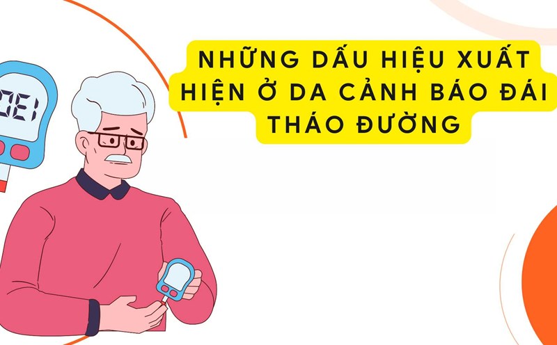 When diabetes affects the skin, this is often a sign of a rather high blood sugar condition. Graphic photo: Huong Son