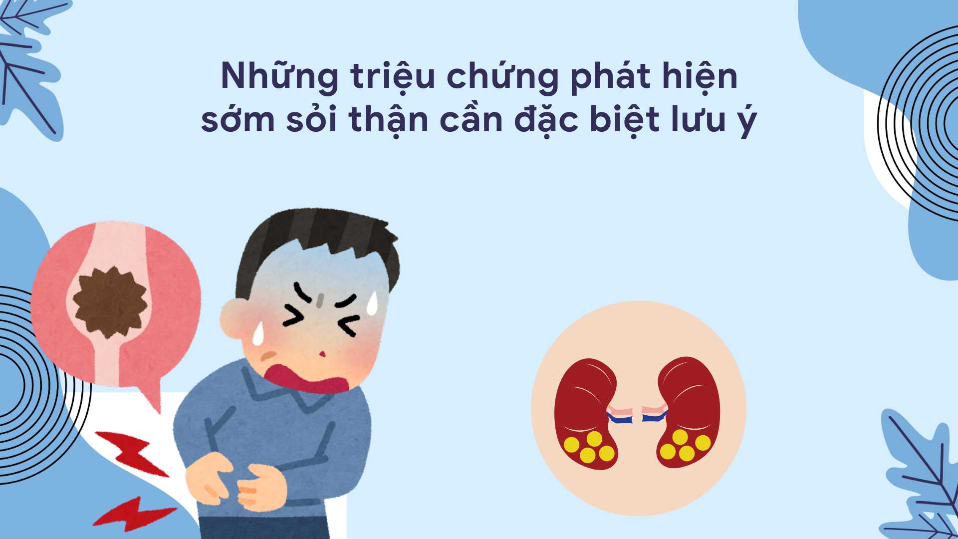 Changes in your urine are a sign that you may have kidney stones. Graphic photo: Huong Son