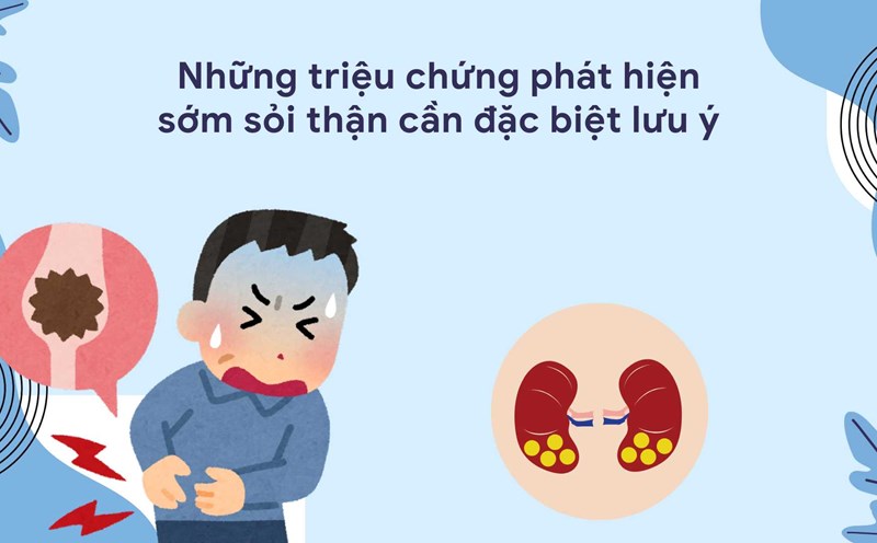 Changes in your urine are a sign that you may have kidney stones. Graphic photo: Huong Son