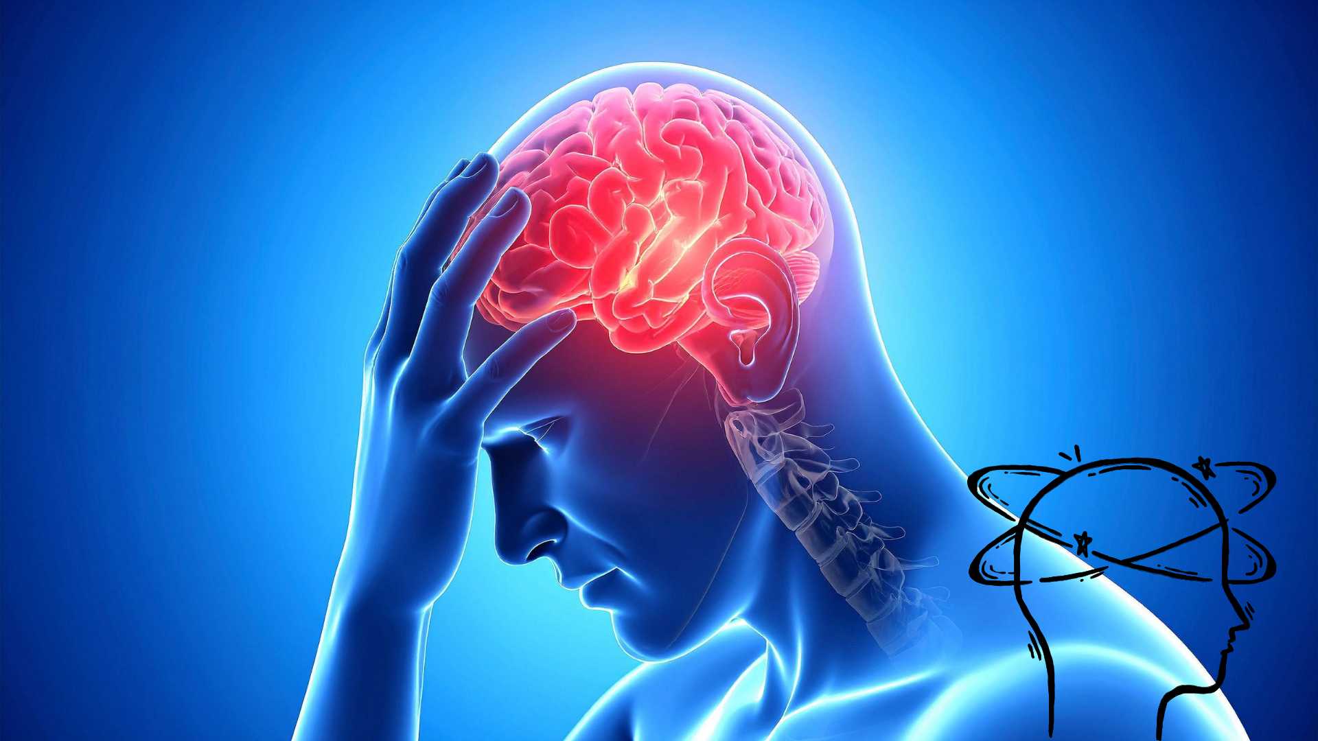 migraine is a common disease. Photo: WHO