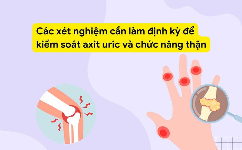 Testing for uric acid in the blood is the most basic step to assess the risk of gout and purine metabolism disorder. Graphic photo: Huong Son