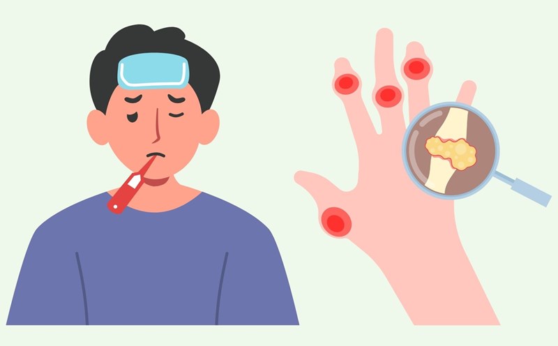 Uric acid. Graphics: Linh Dan