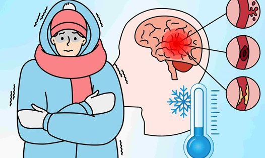 4 dấu hiệu cảnh báo đột quỵ dễ gặp khi thời tiết lạnh