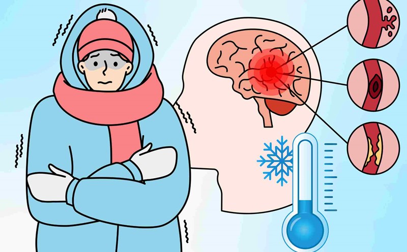 4 warning signs of stroke in cold weather