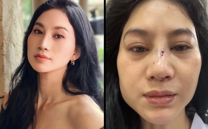 Actress Phi Ngoc Anh said she was abused by her ex-husband. Photo: Provided by the character.