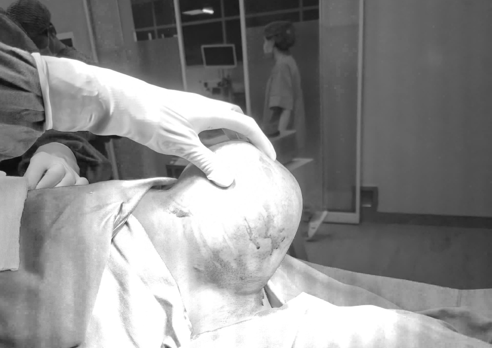 Successfully operated on a 1.5 kg shoulder tumor for the patient. Photo: BVCC