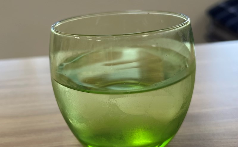 Drinking less water is one of the causes of weak kidneys. Photo: Kieu Vu