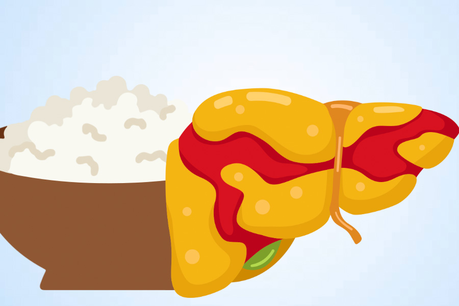 The health impact of white rice on people with fatty liver. Graphics: Thien Nhan