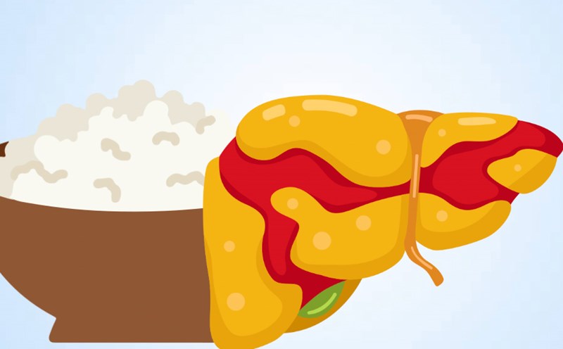 The health impact of white rice on people with fatty liver. Graphics: Thien Nhan