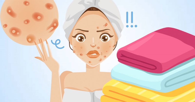 Luôn giữ vệ sinh da và các vật dụng tiếp xúc với mặt để hạn chế vi khuẩn lây lan