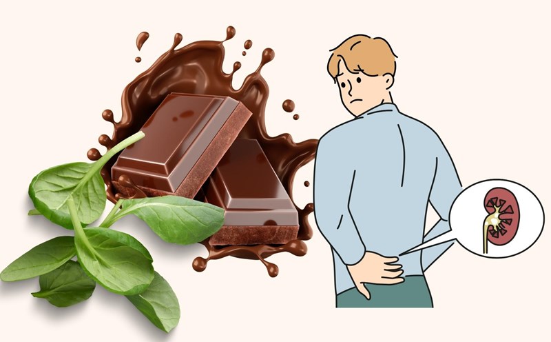 Familiar foods silently cause kidney stones. Graphics: Linh Dan