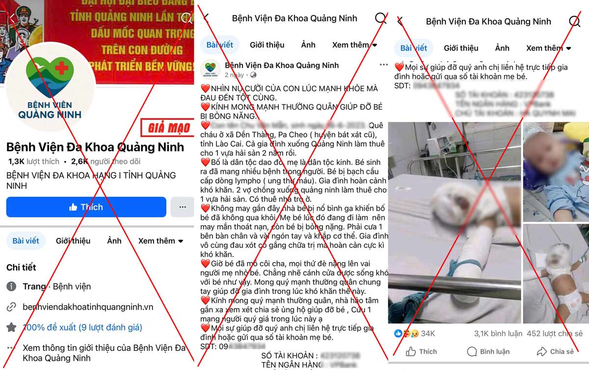 Quang Ninh省総合病院偽のファンページは、火傷を負った小児患者の写真を投稿し、「母親」の慈善寄付を呼びかける内容と個人アカウントを添えています。写真:Quang Ninh省総合病院。