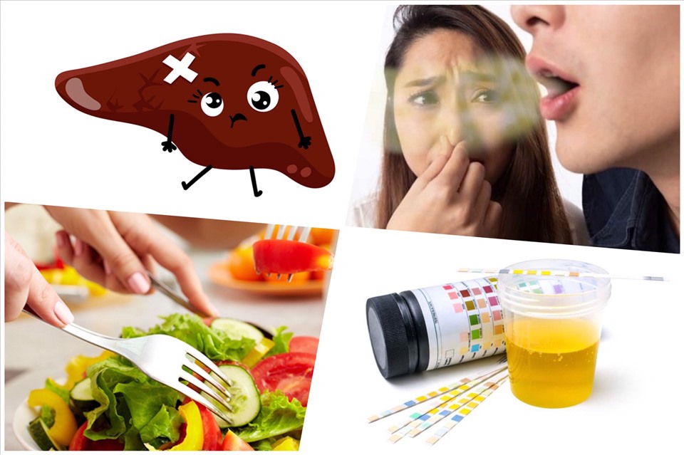 Say goodbye to the fragrant breath. Graphics: Anh Nhien