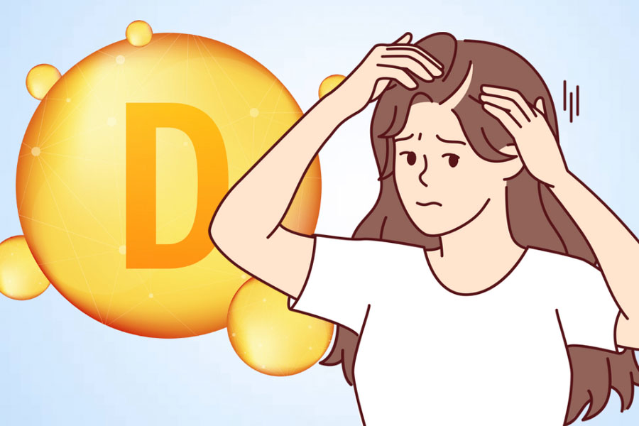 Nồng độ vitamin D thấp có thể gây rụng tóc. Đồ họa: Thiện Nhân