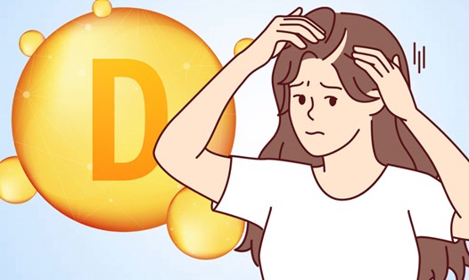 Nồng độ vitamin D thấp có thể gây rụng tóc. Đồ họa: Thiện Nhân