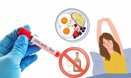 Người bệnh gút nên đặc biệt chú ý đến việc hạ axit uric. Đồ họa: Hạ Mây