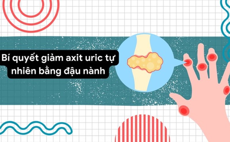 People with high uric acid should prioritize tofu. Graphic photo: Huong Son