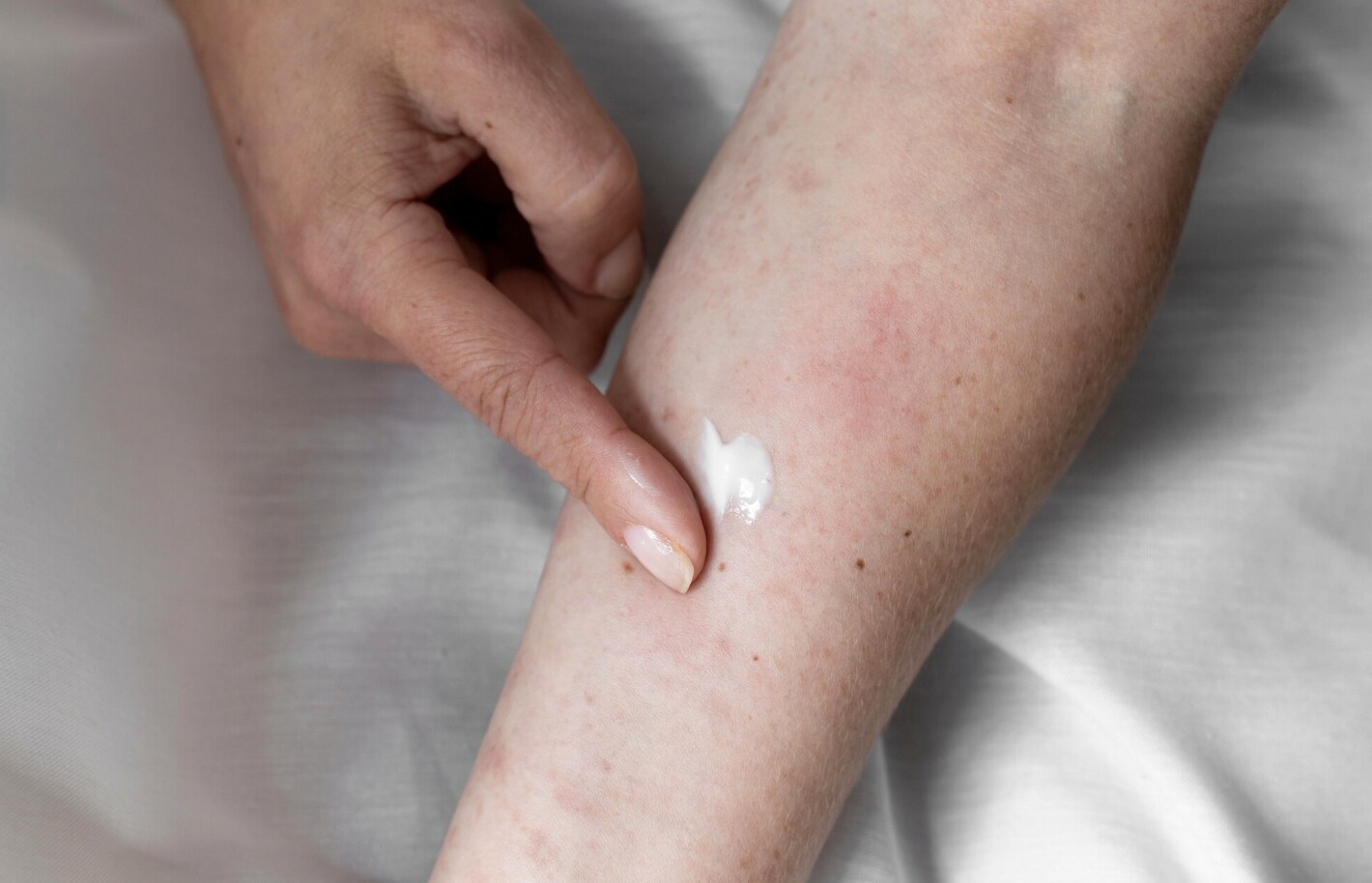 External skin diseases are easy to get when traveling in flooded areas. Photo: Thuy Duong