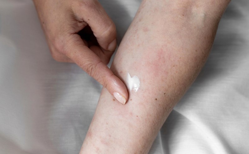 External skin diseases are easy to get when traveling in flooded areas. Photo: Thuy Duong
