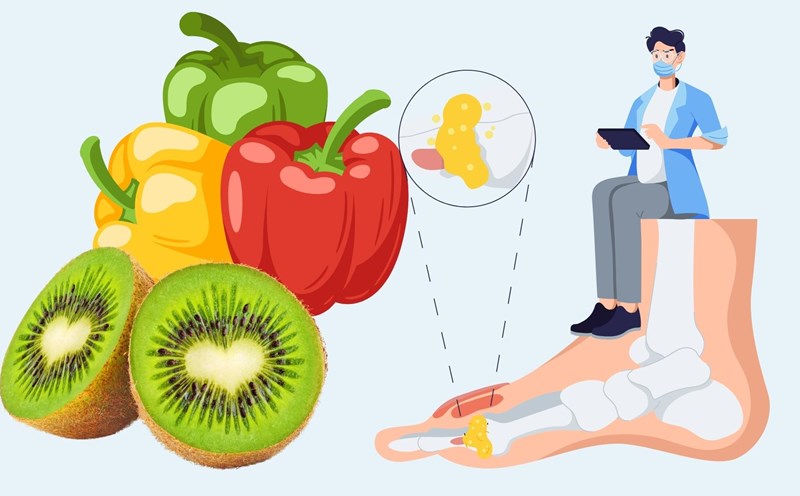 Eating this fruit every day, uric acid naturally decreases. Graphics: Linh Dan