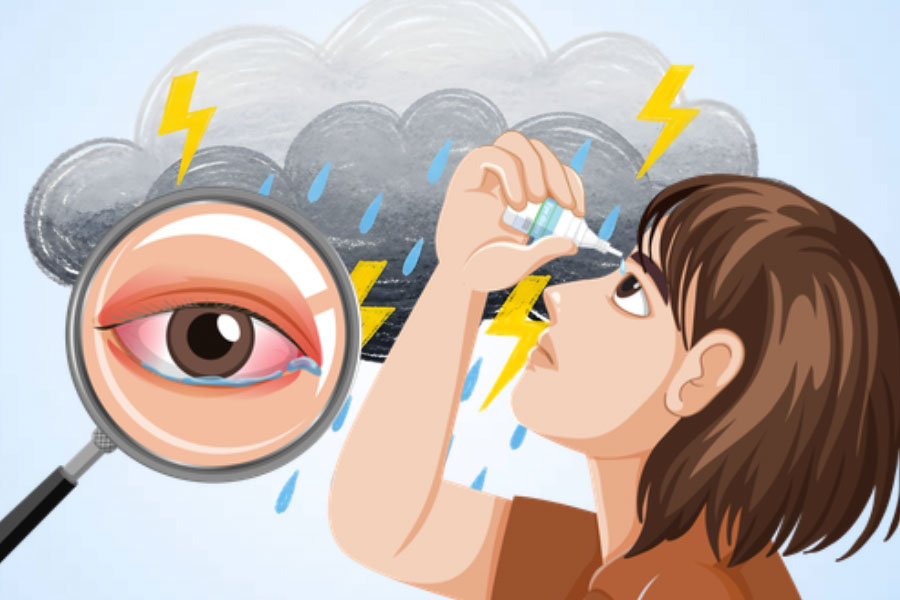 Simple solutions for dry eyes in the wet rainy season. Graphics: Thien Nhan